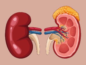 Kidney Failure: Stages, ESRD, Causes, Symptoms & Treatment