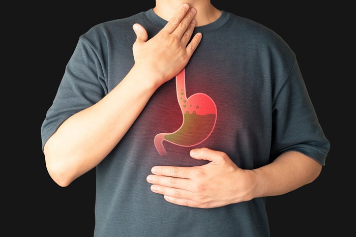 Top Homeopathic Remedies to Treat Acidity Naturally in Thane