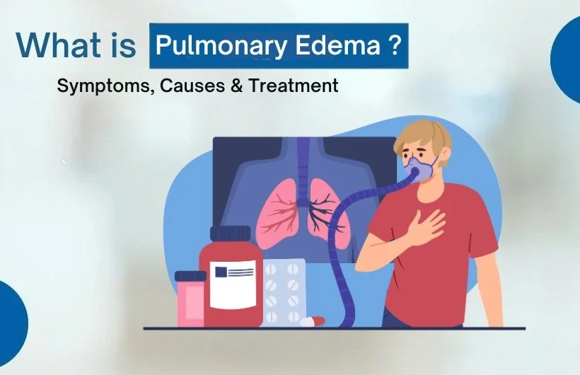 Simple Guide to Symptoms, Causes and Homeopathy Care