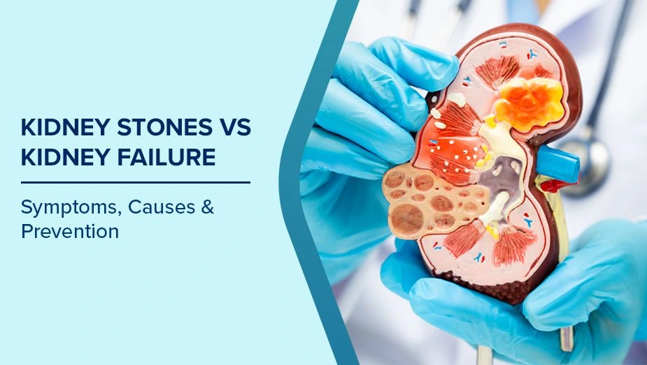 Homeopathy treatment for stone in kidney in Thane